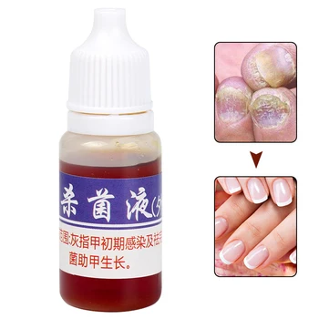 10 ml profesionalni noktiju nail repair Tretman noktiju liječenje noktiju tekućina hrani antifungalna nokte infekcija kineske trave Liqui