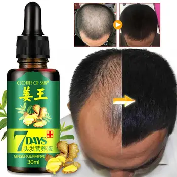 30 ml Эссенция za rast kose serum brzo snažan eterično ulje za kosu tekuće liječenje spriječiti gubitak kose Proizvoda Zdravlje za Njegu kose