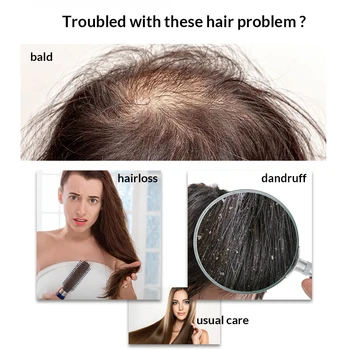 OMYLADY Anti Hair Loss Hair Growth Spray Essential Liquid+organsko eterično ulje za kosu duboko hrani linije rasta kose obnavlja oštećenu kosu